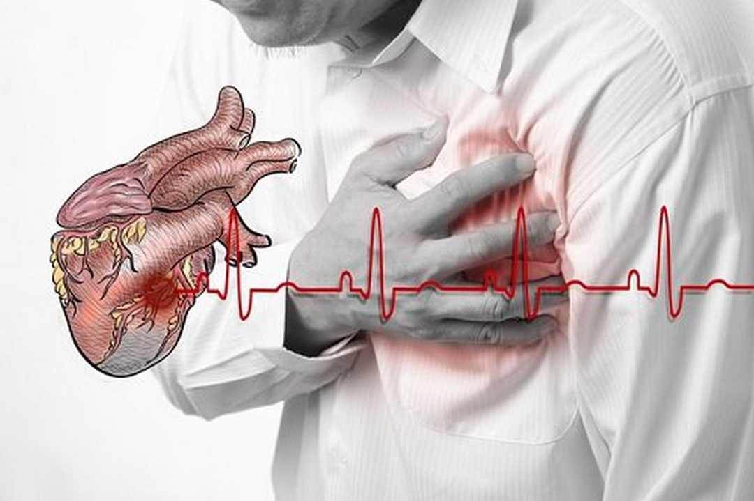 Bệnh lý nguy hiểm về tim mạch