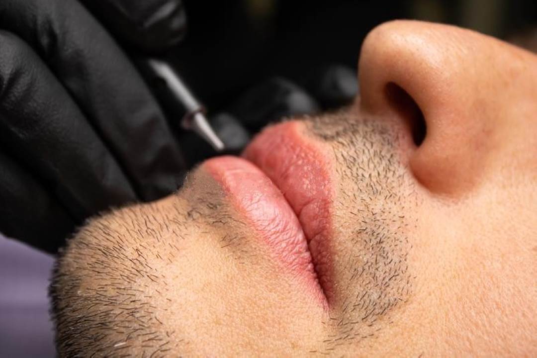 khử thâm môi nam có hiệu quả không?